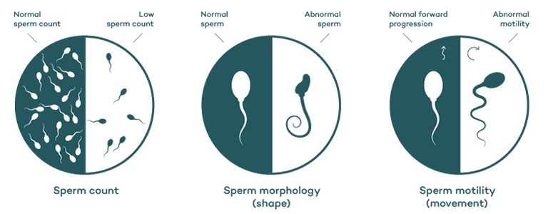 The role of sperm health in&nbsp;conception