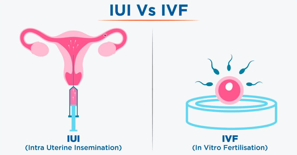 The difference between IUI and&nbsp;IVF
